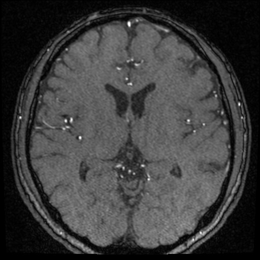 Click on the Serie image to view the images of VILLANUEVA, WILLIAM A.